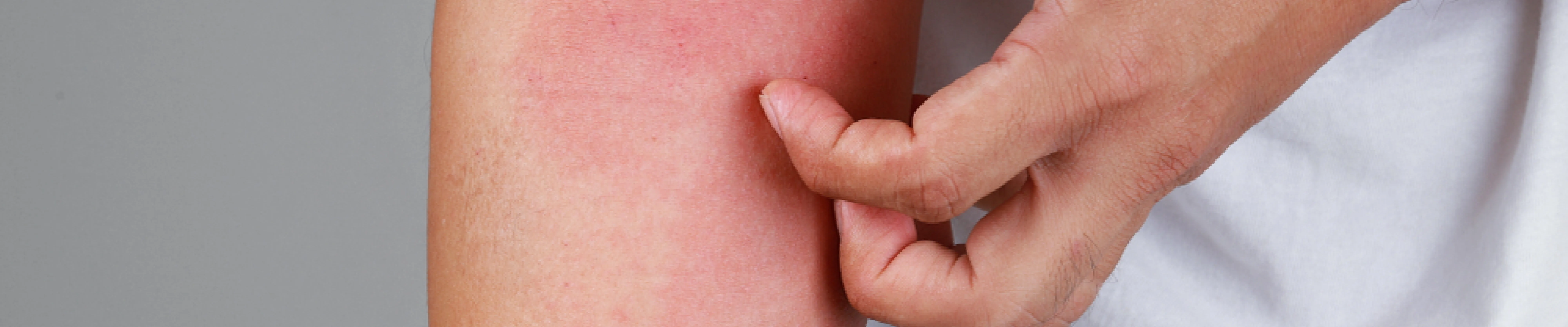 carpet cleaning in new jersey, carpet cleaning in new jersey, carpet cleaning new jersey, carpet cleaners in new jersey, carpet cleaners in new jersey, commercial carpet cleaning, commercial carpet cleaning in new jersey, new jersey rug cleaners, rug cleaning services in new jersey, same day carpet cleaning, same day rug cleaning